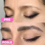 Serum za rast obrva PureBrow