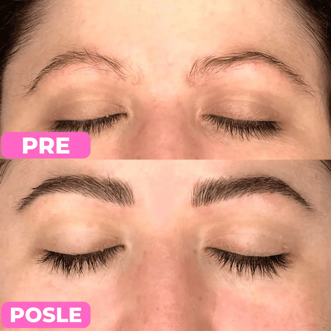 Serum za rast obrva PureBrow