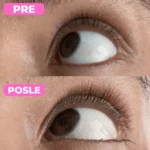 Serum za rast trepavica