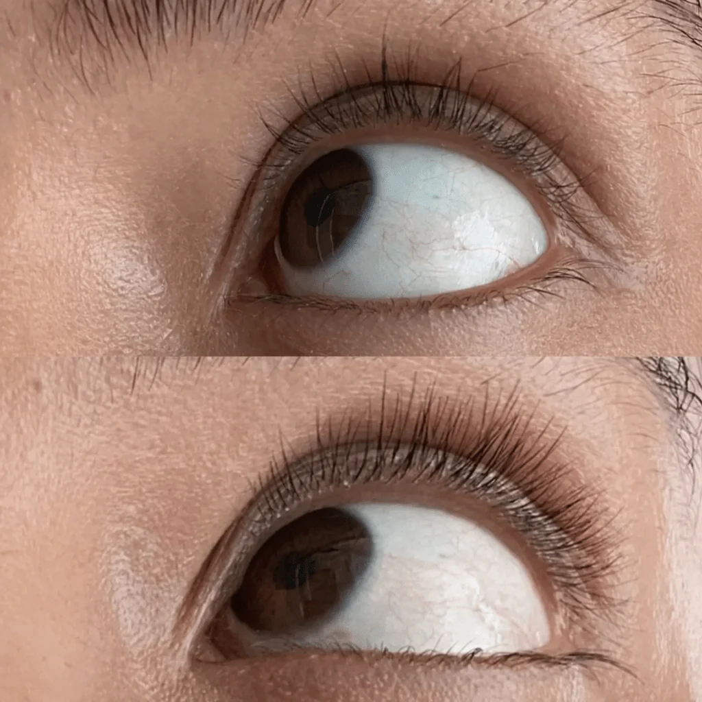 purelash-serum-za-rast-trepavica-6575138