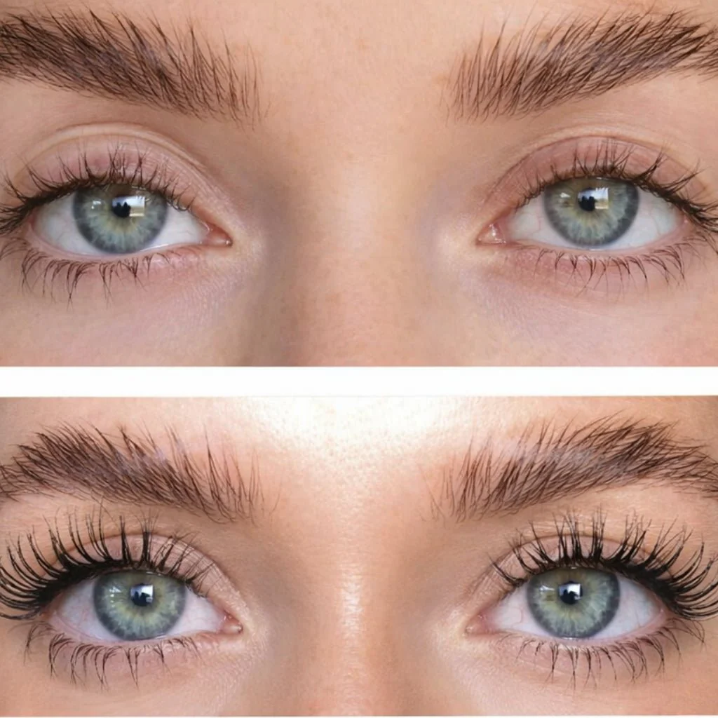 purelash-serum-za-rast-trepavica-6939865